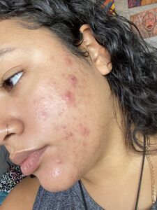 Liltriste Bbytriste Hot photos Tristeluna Tristebby XXX